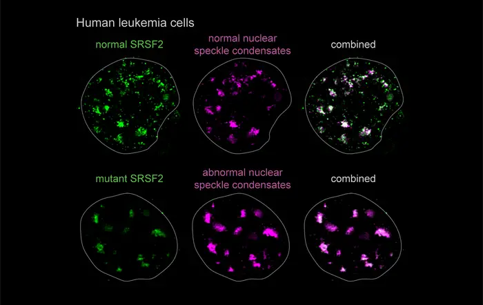 Human leukemia cells
