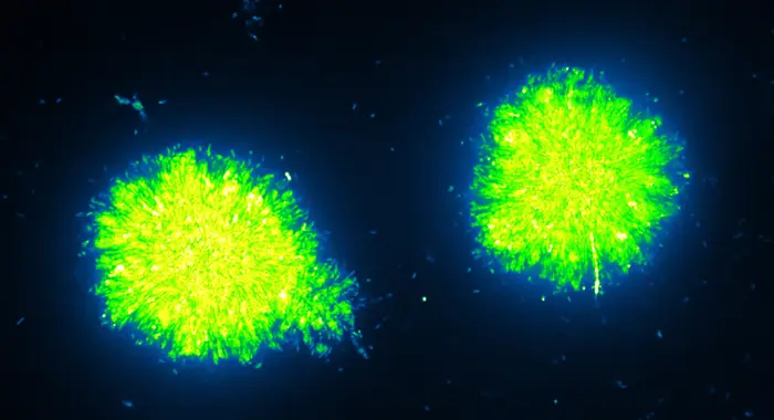A mutant strain of V. cholerae grows sprawling biofilms — dense bacterial communities that can make infections harder to treat.