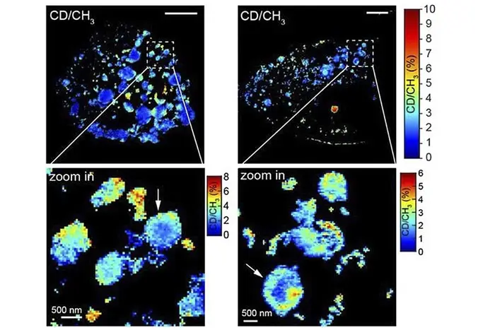 MAGNIFIERS captured newly synthesized Huntingtin aggregates (in red) with nanoscale resolution in the Huntington disease model.