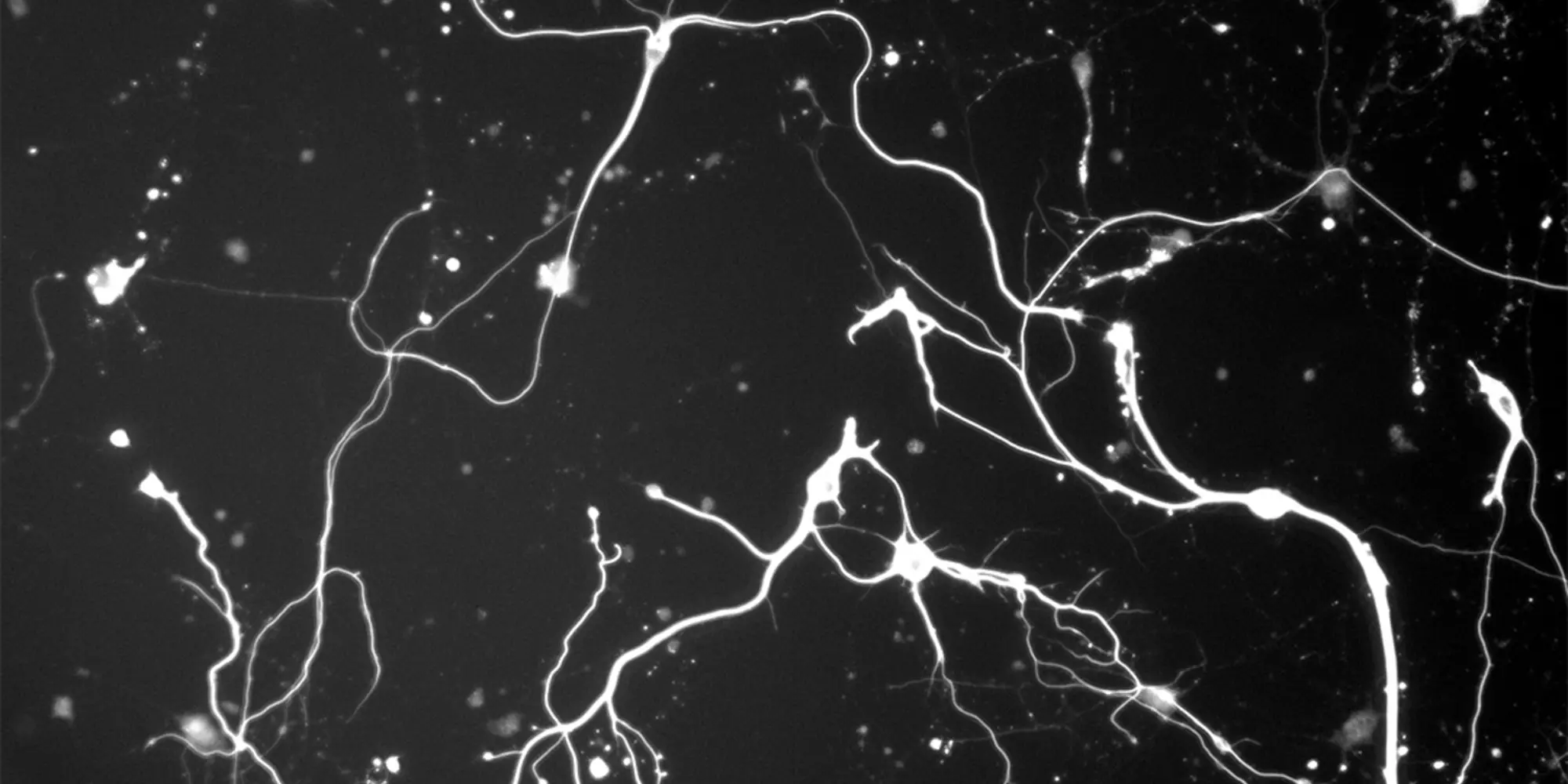 black and white abstract of  neurons