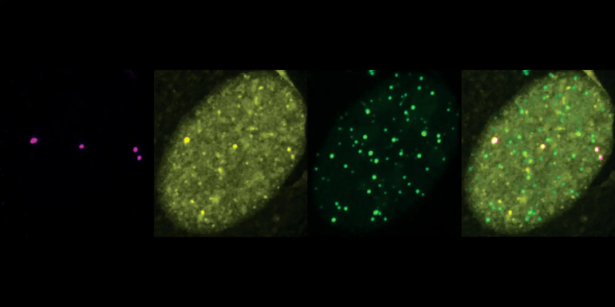 SUMO and DNA repair factors co-localize to telomeres in ALT cancer cells.