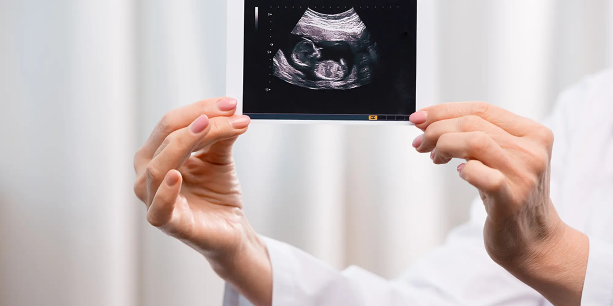 A person holding an image of a fetus.