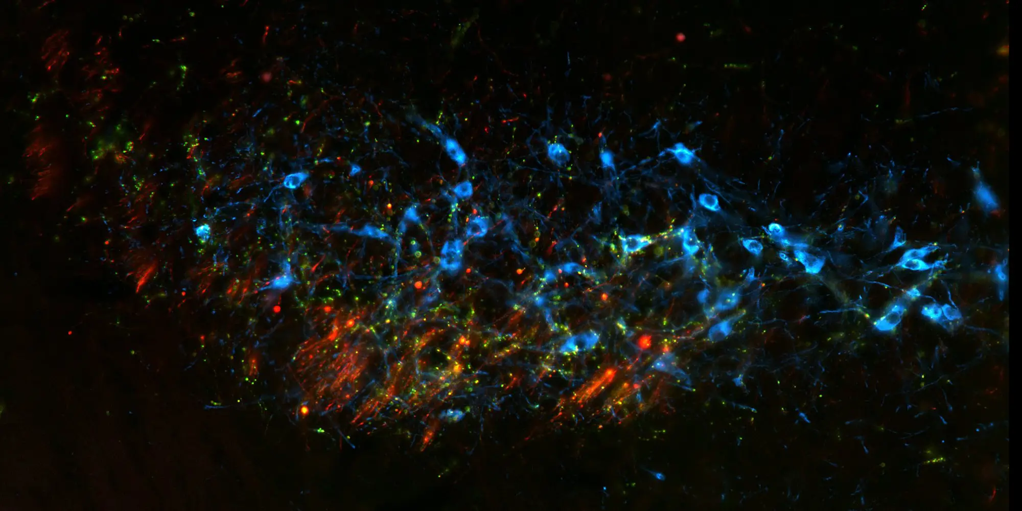 Colorful image shows different types of nerves.