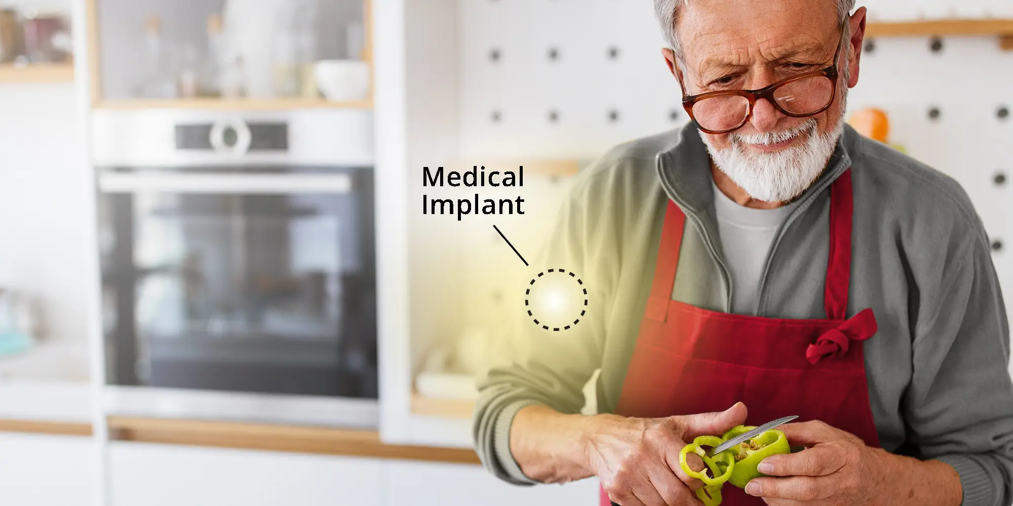 Medical implant illustration