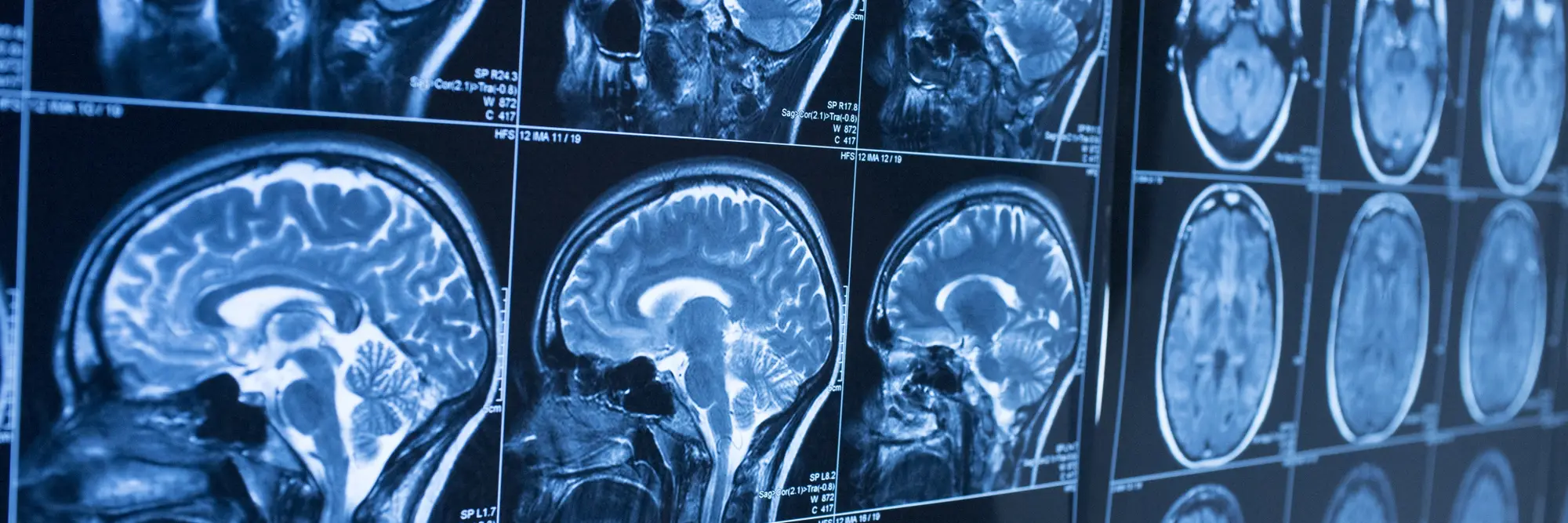 A wall full of brain scans.