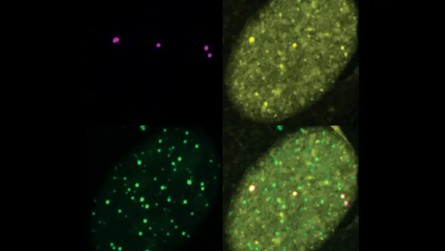 SUMO and DNA repair factors co-localize to telomeres in ALT cancer cells.