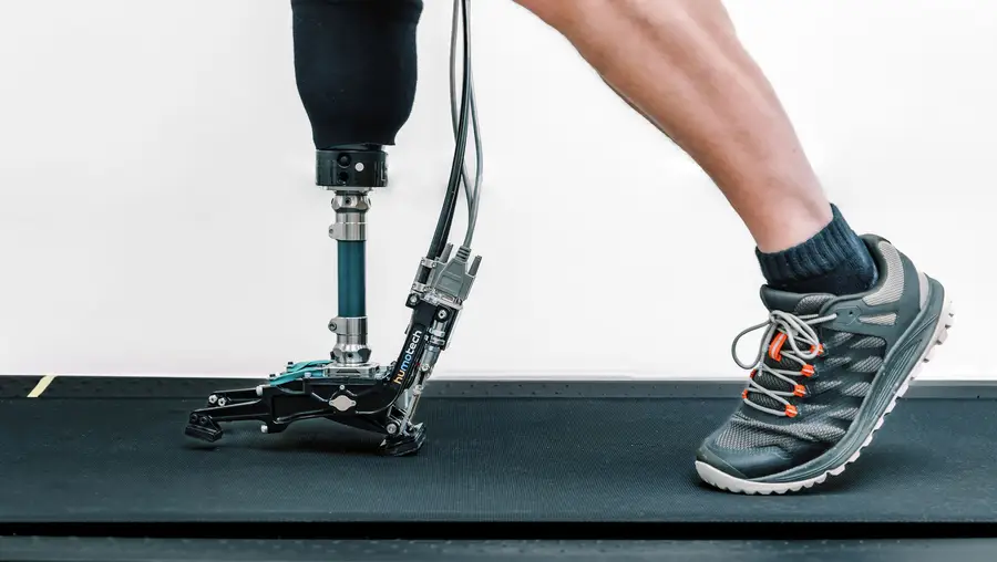 The images shows the legs of a person wearing a prosthetic foot on their right leg walking on a treadmill