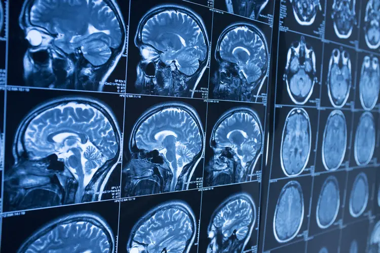 A wall full of brain scans. 