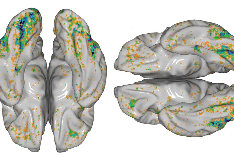 Graphic depicting a region of the brain's visual cortex that responds to food. The brain is colored in shades of grey, while the highlighted areas of the brain are depicted with orange, green, blue, and purple pixels.