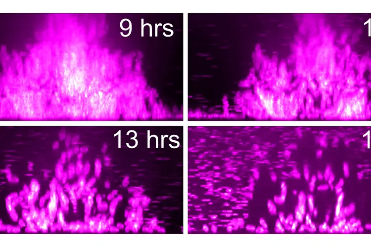 Microscope images showing bacteria leaving a biofilm