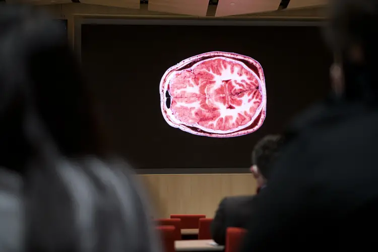 Pink scan of a brain on a computer screen